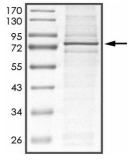 DGKA Protein, Human, Recombinant (Active, His)
