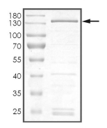 DGKZ Protein, Human, Recombinant (GST)