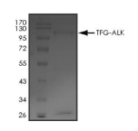 TFG-ALK Protein, Human, Recombinant (GST)