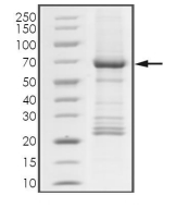 ATM Protein, Human, Recombinant (GST)