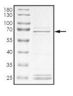ATR Protein, Human, Recombinant (GST)