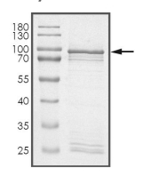 ALK Protein, Human, Recombinant (GST)