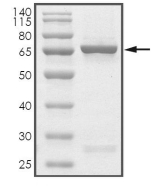 BCKDK Protein, Human, Recombinant (GST)