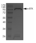 BTK Protein, Rat, Recombinant (GST)
