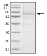 BTK Protein, Human, Recombinant (Active, His)