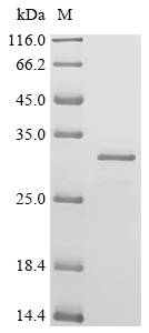 PTX S1 Protein, Bordetella pertussis, Recombinant (His)