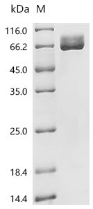 Alkaline Phosphatase/ALPL Protein, Human, Recombinant (His) V2