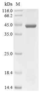 SETDB1 Protein, Human, Recombinant