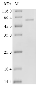 Wnt4 Protein, Human, Recombinant (His & SUMO)