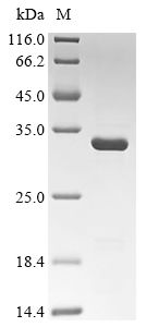 UBE2D3 Protein, Human, Recombinant (His & SUMO)