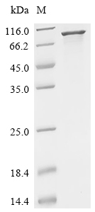PARN Protein, Human, Recombinant (His)