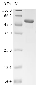 NPR3 Protein, Human, Recombinant (His)
