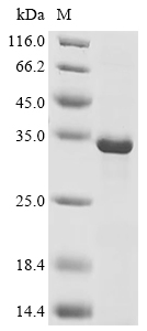 IL-2 Protein, Rhesus macaque, Recombinant (His & Myc & SUMO)