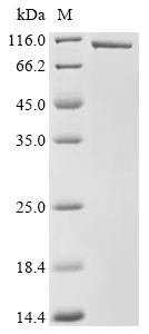 Beta-Catenin Protein, Human, Recombinant (aa 2-781, His)